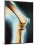 Knee X-ray-null-Mounted Photographic Print