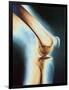 Knee X-ray-null-Framed Photographic Print