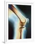 Knee X-ray-null-Framed Photographic Print