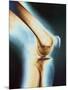 Knee X-ray-null-Mounted Photographic Print