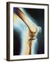 Knee X-ray-null-Framed Photographic Print