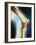 Knee X-ray-null-Framed Photographic Print