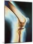 Knee X-ray-null-Mounted Photographic Print