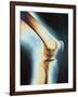 Knee X-ray-null-Framed Photographic Print