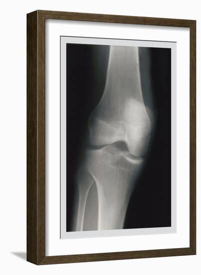 Knee-null-Framed Art Print