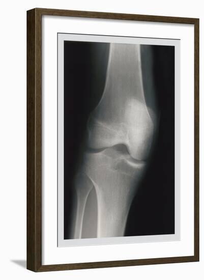 Knee-null-Framed Art Print