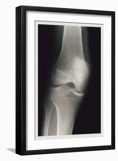 Knee-null-Framed Art Print