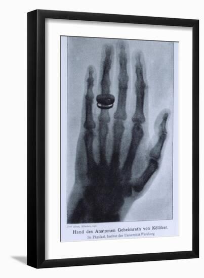 Konrad Roentgen's X-Ray of the Hand of Showing Bones and the Ring, 1895-null-Framed Art Print