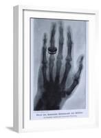 Konrad Roentgen's X-Ray of the Hand of Showing Bones and the Ring, 1895-null-Framed Art Print