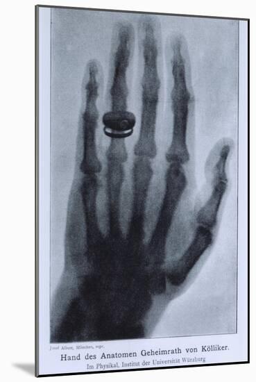 Konrad Roentgen's X-Ray of the Hand of Showing Bones and the Ring, 1895-null-Mounted Art Print