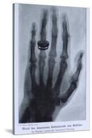 Konrad Roentgen's X-Ray of the Hand of Showing Bones and the Ring, 1895-null-Stretched Canvas