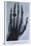 Konrad Roentgen's X-Ray of the Hand of Showing Bones and the Ring, 1895-null-Stretched Canvas