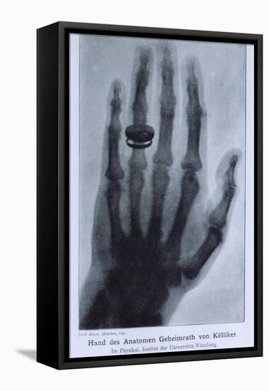 Konrad Roentgen's X-Ray of the Hand of Showing Bones and the Ring, 1895-null-Framed Stretched Canvas