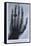 Konrad Roentgen's X-Ray of the Hand of Showing Bones and the Ring, 1895-null-Framed Stretched Canvas