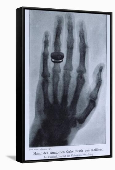 Konrad Roentgen's X-Ray of the Hand of Showing Bones and the Ring, 1895-null-Framed Stretched Canvas