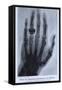 Konrad Roentgen's X-Ray of the Hand of Showing Bones and the Ring, 1895-null-Framed Stretched Canvas