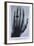 Konrad Roentgen's X-Ray of the Hand of Showing Bones and the Ring, 1895-null-Framed Art Print