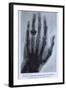 Konrad Roentgen's X-Ray of the Hand of Showing Bones and the Ring, 1895-null-Framed Art Print