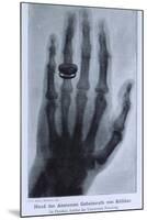 Konrad Roentgen's X-Ray of the Hand of Showing Bones and the Ring, 1895-null-Mounted Art Print