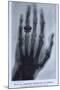 Konrad Roentgen's X-Ray of the Hand of Showing Bones and the Ring, 1895-null-Mounted Art Print