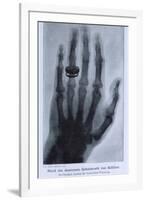 Konrad Roentgen's X-Ray of the Hand of Showing Bones and the Ring, 1895-null-Framed Art Print