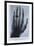 Konrad Roentgen's X-Ray of the Hand of Showing Bones and the Ring, 1895-null-Framed Art Print