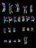 Karyotype of Chromosomes In Down's Syndrome-L. Willatt-Mounted Photographic Print