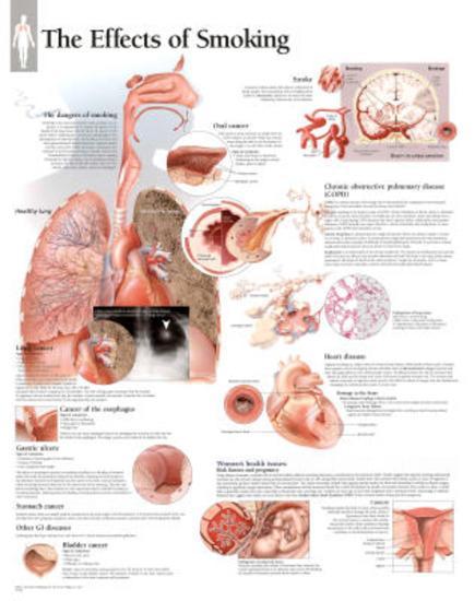 Laminated Poster, , large