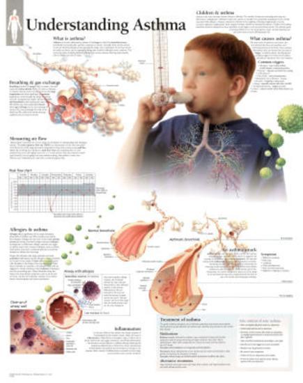 Laminated Poster, , large