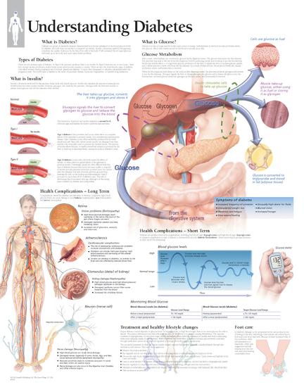 Laminated Poster, , large