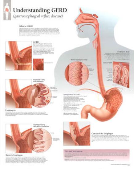 Laminated Poster, , large