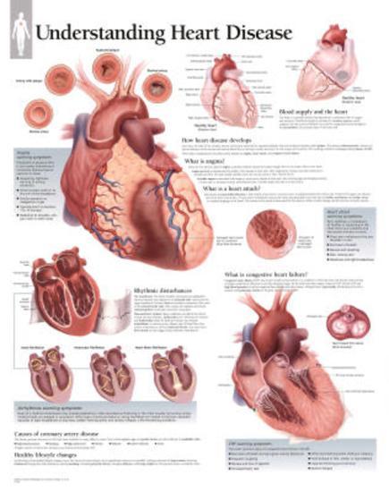 Laminated Poster, , large