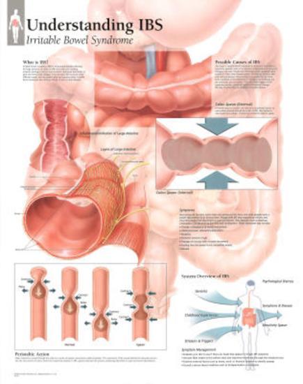 Laminated Poster, , large