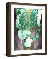 Large Intestine, X-ray-Du Cane Medical-Framed Photographic Print