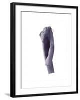 Larky Tiree Trousers, 2004-Miles Thistlethwaite-Framed Giclee Print