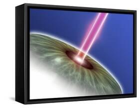 Laser Eye Surgery, Computer Artwork-PASIEKA-Framed Stretched Canvas