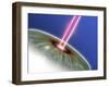 Laser Eye Surgery, Computer Artwork-PASIEKA-Framed Photographic Print