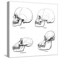 Lateral View of the Skull or Profile, 1848-null-Stretched Canvas