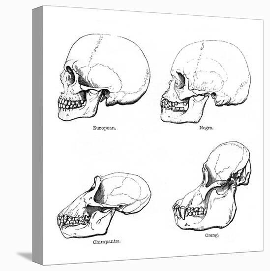 Lateral View of the Skull or Profile, 1848-null-Stretched Canvas