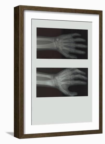 Left Hand-null-Framed Art Print