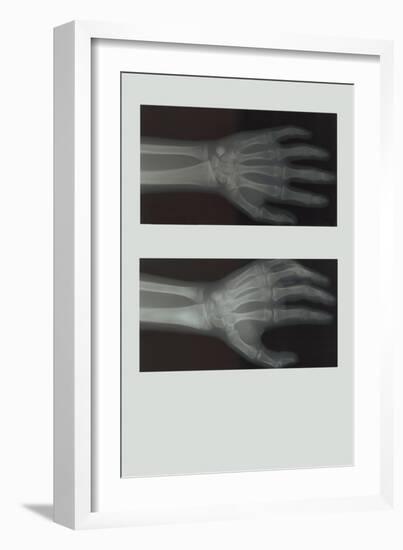 Left Hand-null-Framed Art Print