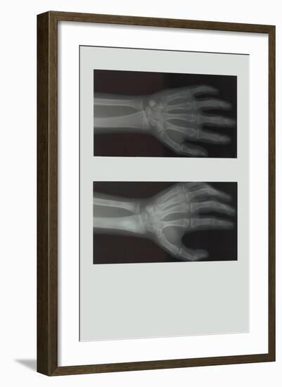Left Hand-null-Framed Art Print