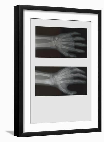 Left Hand-null-Framed Art Print