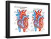 Left Ventricular Hypertrophy-Encyclopaedia Britannica-Framed Poster