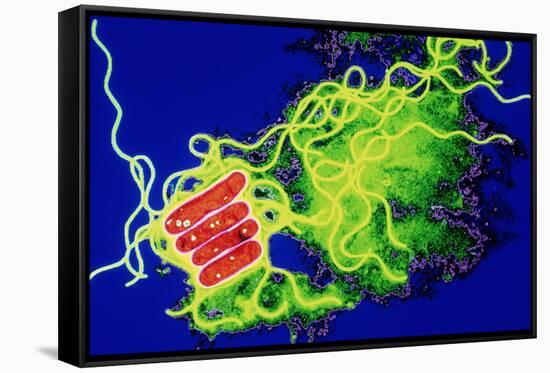 Legionella Bacteria-Dr. Linda Stannard-Framed Stretched Canvas