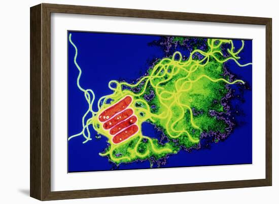 Legionella Bacteria-Dr. Linda Stannard-Framed Photographic Print