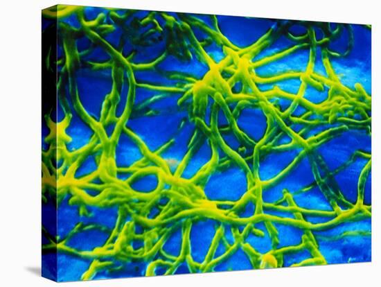 Legionella Pneumophila Bacteria-null-Stretched Canvas