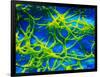 Legionella Pneumophila Bacteria-null-Framed Photographic Print