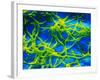 Legionella Pneumophila Bacteria-null-Framed Photographic Print