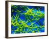 Legionella Pneumophila Bacteria-null-Framed Photographic Print